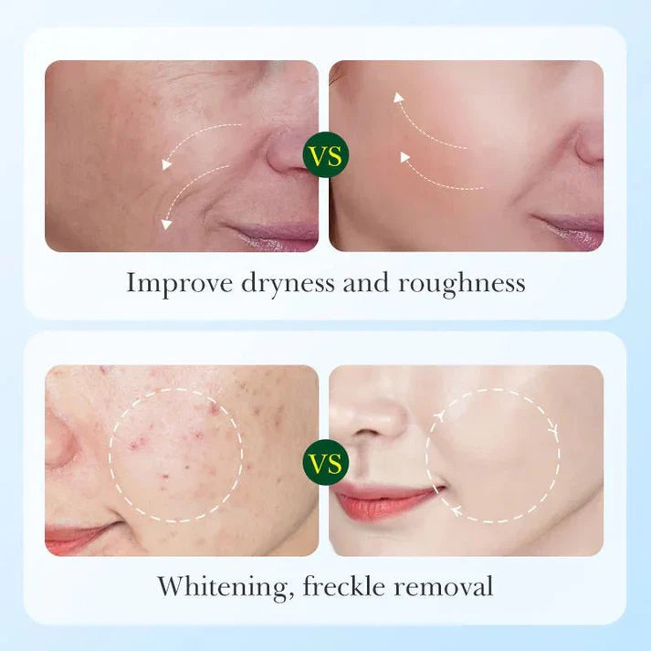 Sadoer - Licorice Root Whitening Skin Care Set (Original) | Brightening